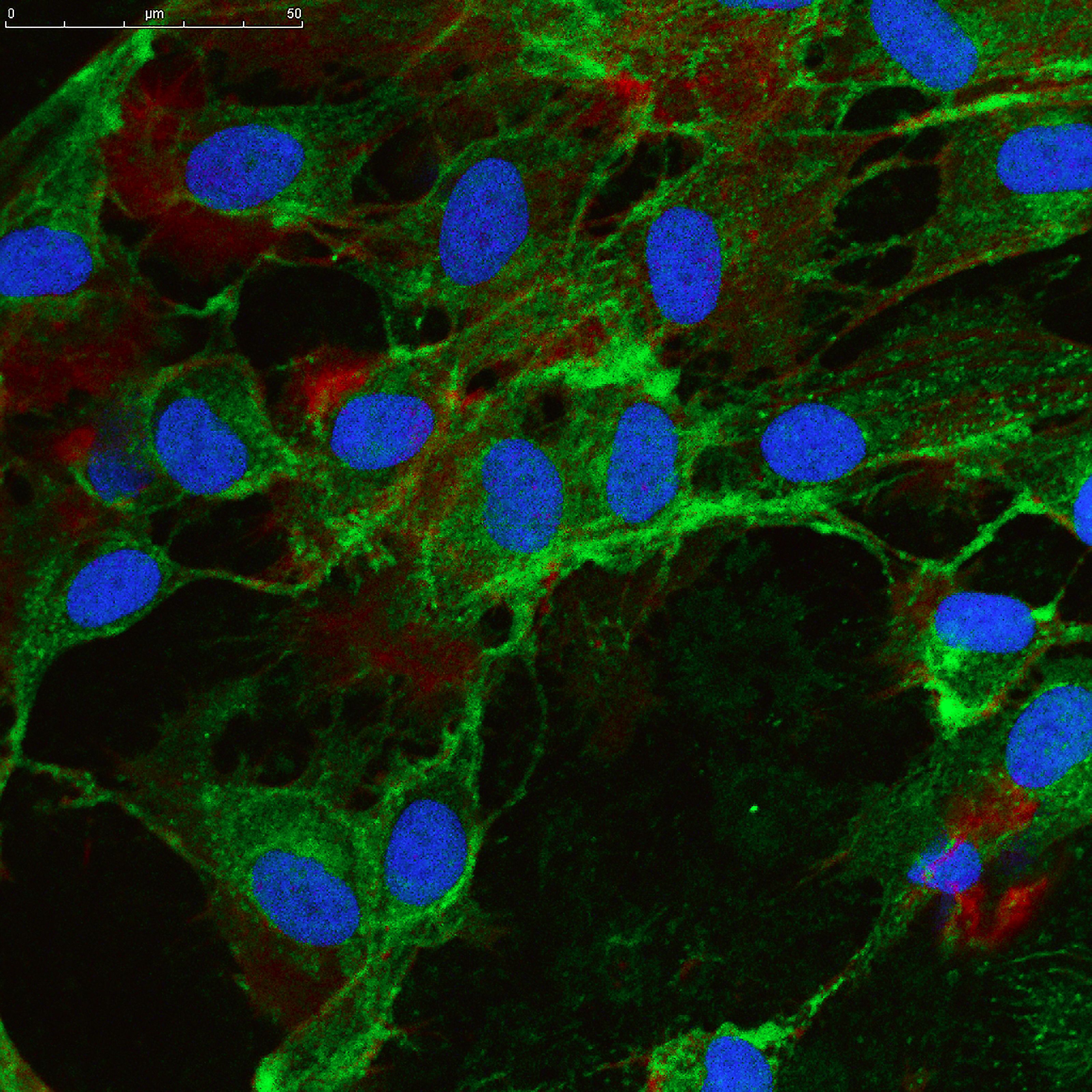 Mesenchymal cells viewed under a microscope